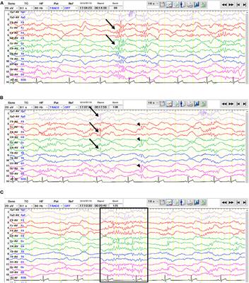 Magnetic Resonance Imaging and Histopathologic Findings From a Standard Poodle With Neonatal Encephalopathy With Seizures